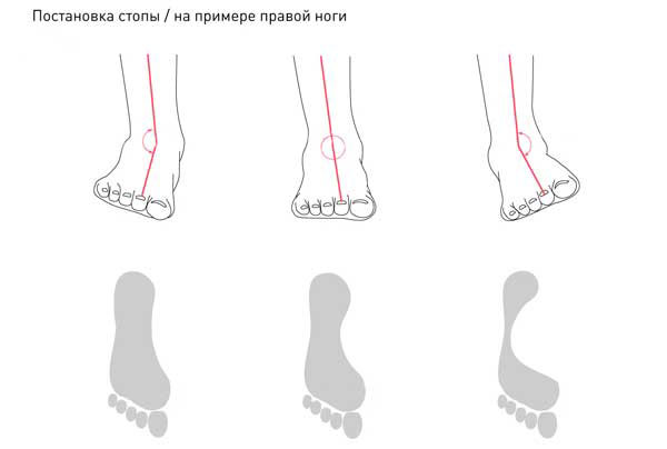 Kaip pasirinkti tinkamą avalynę