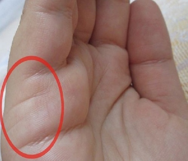 Santuokos linija ant rankos