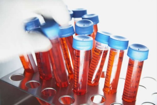 Analizuoja antimulylerov hormoną