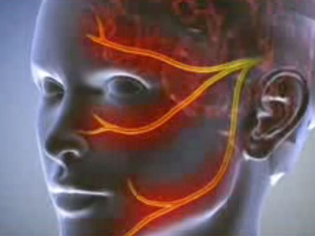 Neuralgija: simptomai, nuotraukos, gydymas